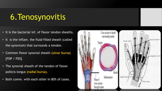 6.Tenosynovitis
• It is the bacterial inf. of flexor tendon sheaths.
• It is the inflam. the fluid-filled sheath (called
the synovium) that surrounds a tendon.
• Common flexor synovial sheath (ulnar bursa)
[FDP / FDS]
• The synovial sheath of the tendon of flexor
pollicis longus (radial bursa).
• Both comm. with each other in 80% of cases.
 