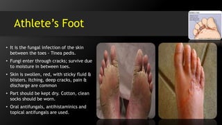 Athlete’s Foot
• It is the fungal infection of the skin
between the toes - Tinea pedis.
• Fungi enter through cracks; survive due
to moisture in between toes.
• Skin is swollen, red, with sticky fluid &
blisters. Itching, deep cracks, pain &
discharge are common
• Part should be kept dry. Cotton, clean
socks should be worn.
• Oral antifungals, antihistaminics and
topical antifungals are used.
 