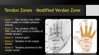 Tendon Zones – Modified Verdan Zone
• Zone 1 - One tendon only (FDP)
from middle of middle phalanx
distally
• Zone 2 - Two tendons (FDS &
FDP) from MCP joints to middle of
middle phalanx
• Zone 3 - Central palm
• Zone 4 - Tendons in the carpal
tunnel
• Zone 5 - Tendons proximal to the
carpal tunnel
 