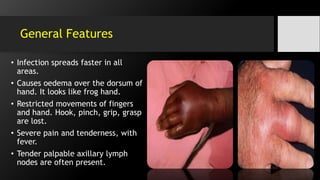 General Features
• Infection spreads faster in all
areas.
• Causes oedema over the dorsum of
hand. It looks like frog hand.
• Restricted movements of fingers
and hand. Hook, pinch, grip, grasp
are lost.
• Severe pain and tenderness, with
fever.
• Tender palpable axillary lymph
nodes are often present.
 