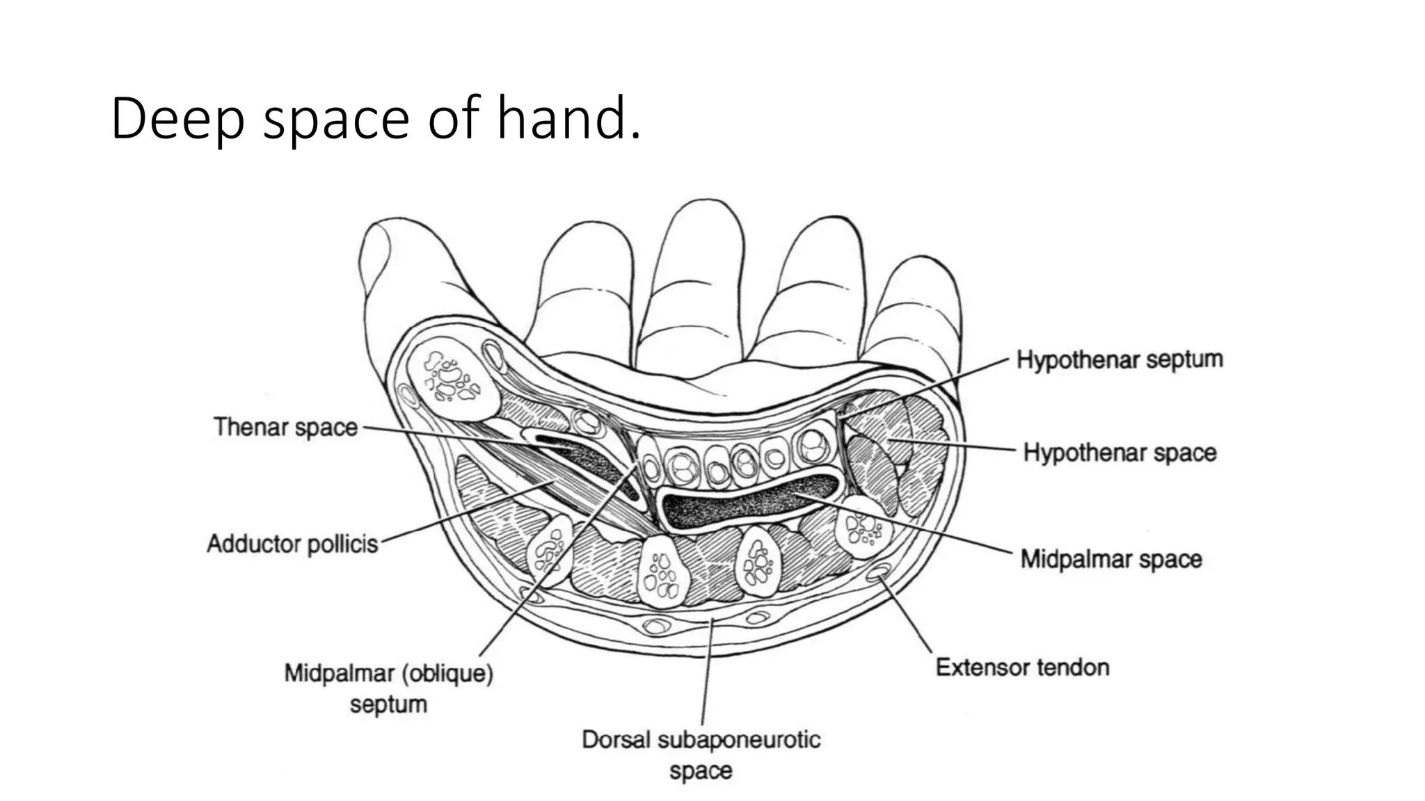 Hand infections | PDF