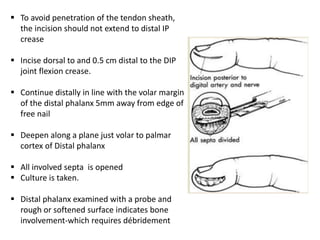 Incision Finger Pulp Acute Hand infections | PPTX