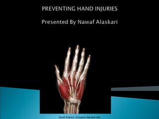 Hand injuries | PPS