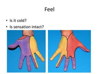 Feel
• Is it cold?
• Is sensation intact?
 