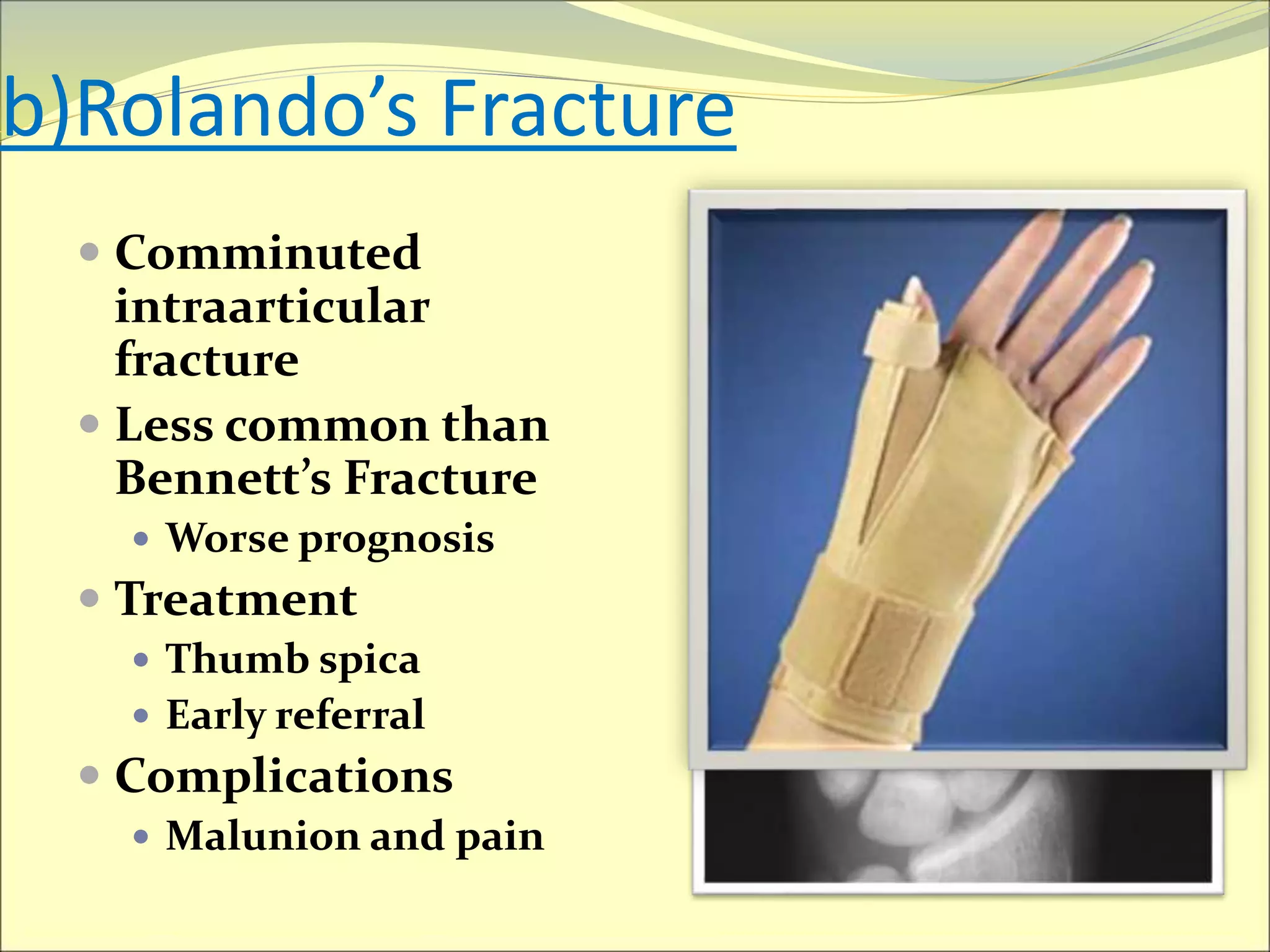 Hand injuries | PPTX