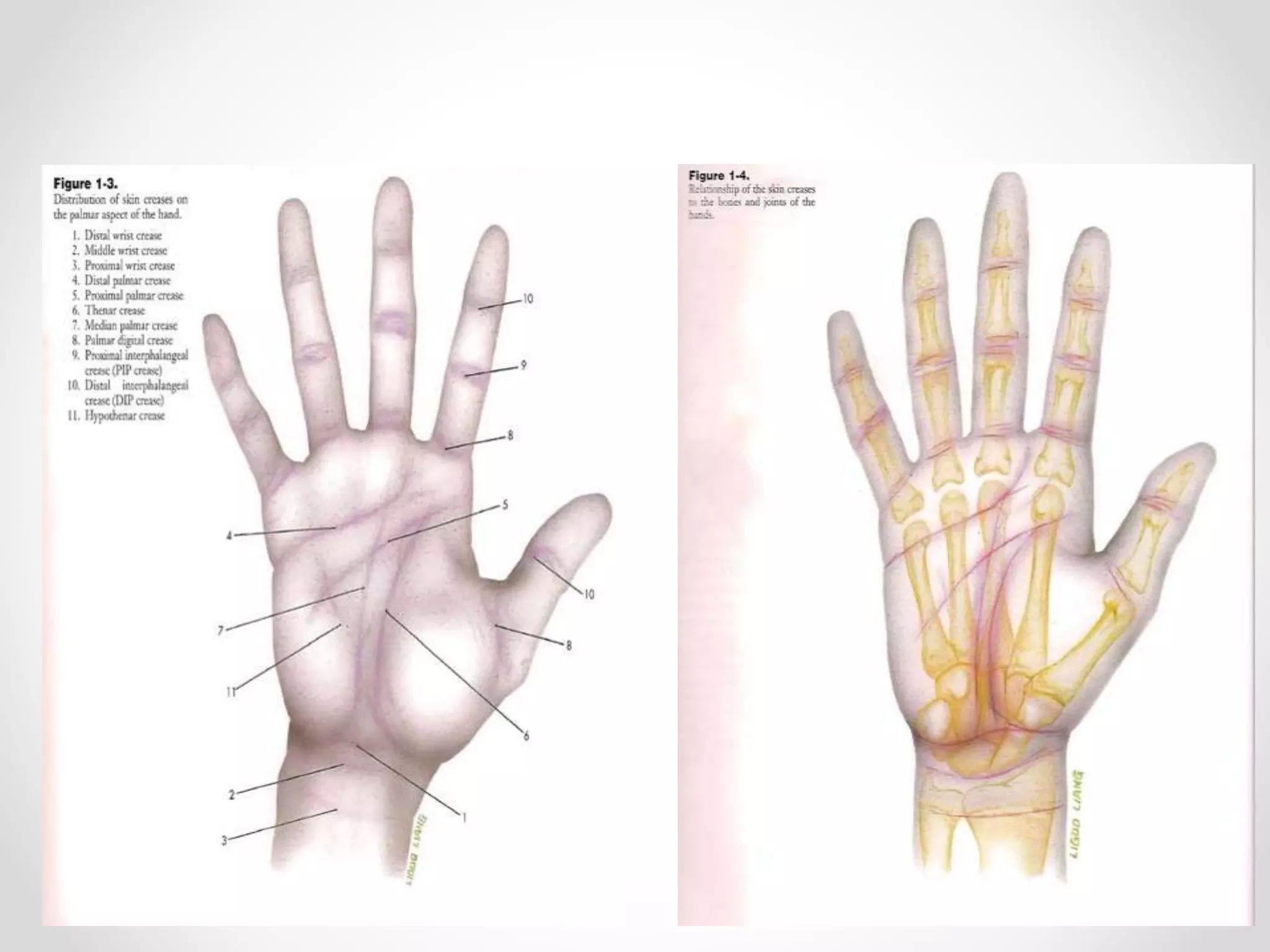 Major Hand Injuries Hand injuries | PPTX