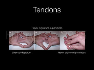 Tendons
Emergency Medicine Practice © 2011 6 ebmedicine.net • June 2011
ligaments, tendons, muscles, and nerves. Magnetic
resonance angiography (MRA) can be used to
evaluate vascular structures.
Ultrasonography
In the hands of a skilled operator, ultrasound can
be used to visualize soft tissue structures. The small
structures of the hand are, however, difﬁcult to scan
and usually require high-frequency linear probes
and an experienced ultrasonographer.
ogy’s published guidelines, any clinically suspected
fracture or dislocation in the hand should be evalu-
ated with at least posteroanterior and lateral views,
and an oblique view should be strongly considered.6
Conventional radiography can also be used to
evaluate lacerations that are suspected to contain a
retained foreign body. The current gold standard for
detecting radio-opaque materials (such as glass and
metal) is careful scrutiny of multi-view x-rays.10,11
Clinicians must keep in mind that some materials
Figure 3. Physical Examination Of Hand Tendons
A, Extensor digitorum. B, Flexor digitorum superficialis. C, Flexor digitorum profundus.
Used with permission of Aaron Andrade, MD.
A B C
Extensor digitorum
Flexor digitorum superﬁcialis
Flexor digitorum profundus
Hilary Lee 2015
 