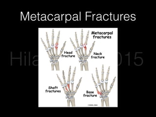 Metacarpal Fractures
Hilary Lee 2015
 