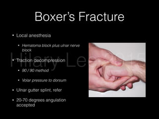 Boxer’s Fracture
• Local anesthesia
• Hematoma block plus ulnar nerve
block
• Traction decompression
• 90 / 90 method
• Volar pressure to dorsum
• Ulnar gutter splint, refer
• 20-70 degrees angulation
accepted 11June 2011 • ebmedicine.net
sor tendon insertion into the distal phalanx, usually
caused by forced ﬂexion of the DIP joint. It is so
named because the ﬂexed DIP cannot be extended
and looks like a mallet. The injury can sometimes
be associated with an avulsion fracture of the dorsal
base of the distal phalanx. The classic strategy for
treating closed mallet ﬁnger injuries with less than
one-third of the joint surface disrupted is continuous
splinting of the DIP joint in full extension to hyper-
Figure 10. The “90-90” Method
Used with permission of Aaron Andrade, MD.
From
wit
Fig
Hy
Use
Hilary Lee 2015
 
