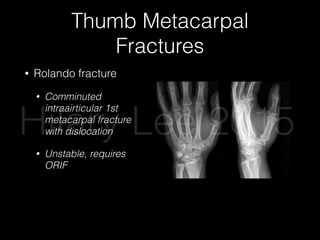 Thumb Metacarpal
Fractures
• Rolando fracture
• Comminuted
intraairticular 1st
metacarpal fracture
with dislocation
• Unstable, requires
ORIF
Hilary Lee 2015
 