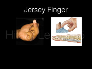 Jersey Finger
Hilary Lee 2015
 