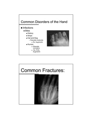 Common Disorders of the Hand
 Infections
 Bites
 History
 Xrays
 Cat and Dog
– Paturella multocida
 Rx: Augmentin
 Human
 Eikenella
corrodens
 Rx: PCN,
Augmentin
Common Fractures:
 