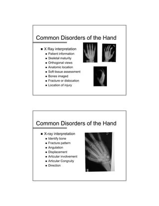 Common Disorders of the Hand
 X Ray interpretation
 Patient information
 Skeletal maturity
 Orthogonal views
 Anatomic location
 Soft tissue assessment
 Bones imaged
 Fracture or dislocation
 Location of injury
Common Disorders of the Hand
 X-ray interpretation
 Identify bone
 Fracture pattern
 Angulation
 Displacement
 Articular involvement
 Articular Congruity
 Direction
 