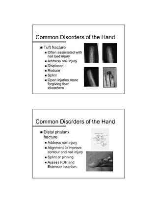 Common Disorders of the Hand
 Tuft fracture
 Often associated with
nail bed injury
 Address nail injury
 Displaced
 Reduce
 Splint
 Open injuries more
forgiving than
elsewhere
Common Disorders of the Hand
 Distal phalanx
fracture
 Address nail injury
 Alignment to improve
contour and nail injury
 Splint or pinning
 Assess FDP and
Extensor insertion
 