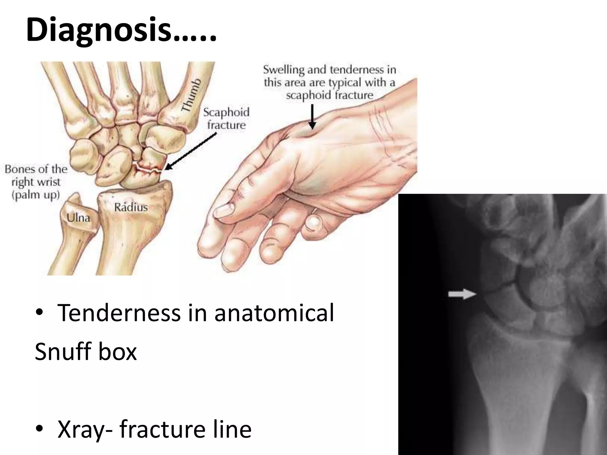 hand_injuries_PPT.ppt