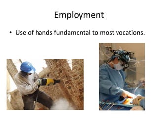 Employment
• Use of hands fundamental to most vocations.
 