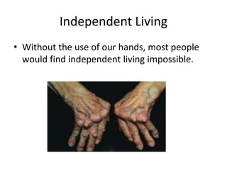 Independent Living
• Without the use of our hands, most people
would find independent living impossible.
 