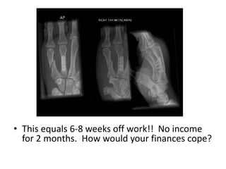 • This equals 6-8 weeks off work!! No income
for 2 months. How would your finances cope?
 