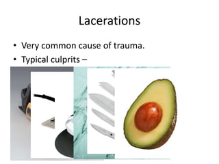 Lacerations
• Very common cause of trauma.
• Typical culprits –
 