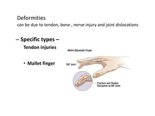 Deformities
can be due to tendon, bone , nerve injury and joint dislocations
– Specific types –
Tendon injuries
• Mallet finger
 