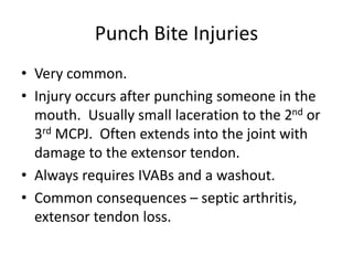 Punch Bite Injuries
• Very common.
• Injury occurs after punching someone in the
mouth. Usually small laceration to the 2nd or
3rd MCPJ. Often extends into the joint with
damage to the extensor tendon.
• Always requires IVABs and a washout.
• Common consequences – septic arthritis,
extensor tendon loss.
 