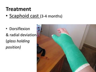 Treatment
• Scaphoid cast (3-4 months)
• Dorsiflexion
& radial deviation
(glass holding
position)
 