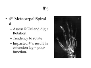 #’s
• 4th Metacarpal Spiral
#
– Assess ROM and digit
Rotation
– Tendency to rotate
– Impacted #’s result in
extension lag = poor
function.
 