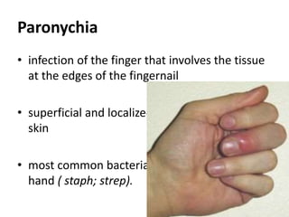 Paronychia
• infection of the finger that involves the tissue
at the edges of the fingernail
• superficial and localized to the soft tissue and
skin
• most common bacterial infection seen in the
hand ( staph; strep).
 