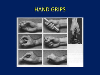 hand injury presentation to be use in safety comaign | PPT