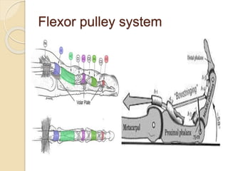 Flexor pulley system
 