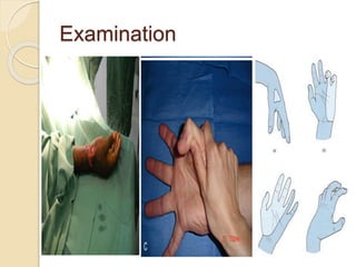 Examination
 