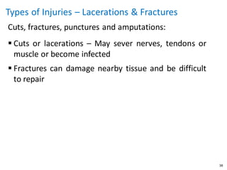 Hand Injuries Types Hand Injury Prevention Presentation-1.pdf