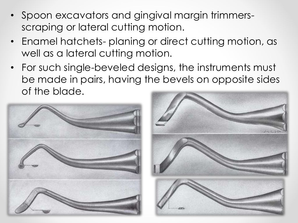 Hand instruments in operative dentistry