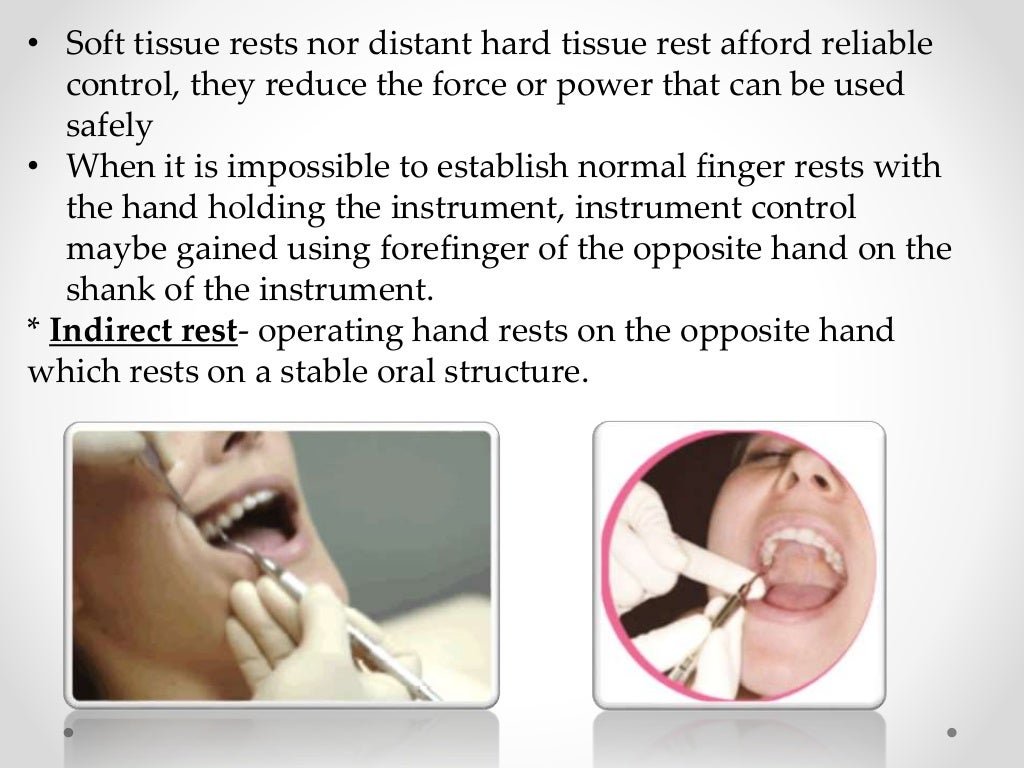 Hand instruments in operative dentistry