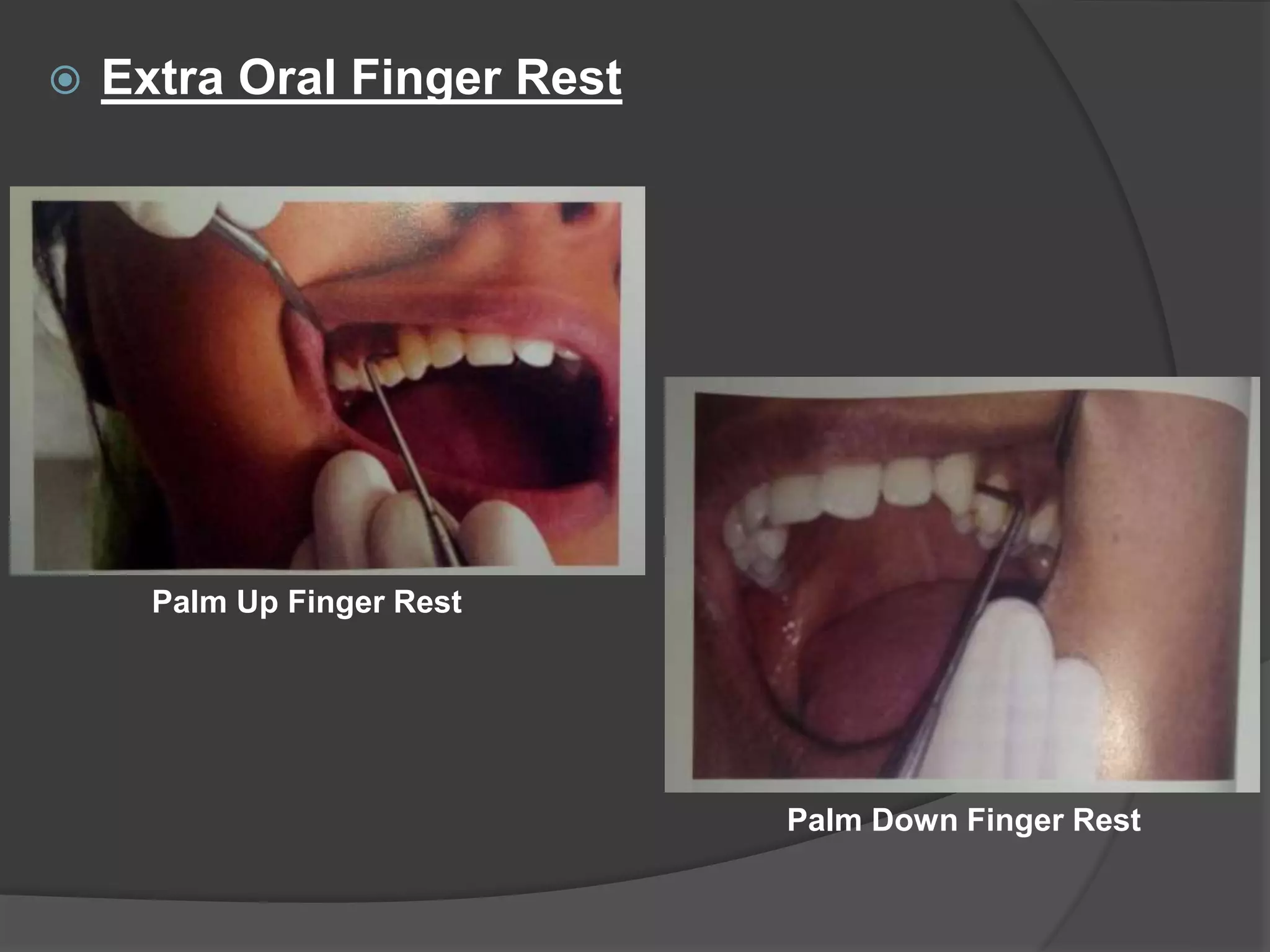 Point Finger Rest Hand cutting instruments | PPTX