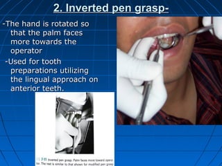 2. Inverted pen grasp-2. Inverted pen grasp-
-The hand is rotated so-The hand is rotated so
that the palm facesthat the palm faces
more towards themore towards the
operatoroperator
-Used for tooth-Used for tooth
preparations utilizingpreparations utilizing
the lingual approach onthe lingual approach on
anterior teeth.anterior teeth.
 