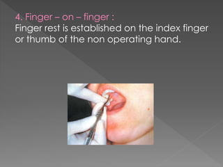 4. Finger – on – finger :
Finger rest is established on the index finger
or thumb of the non operating hand.
 