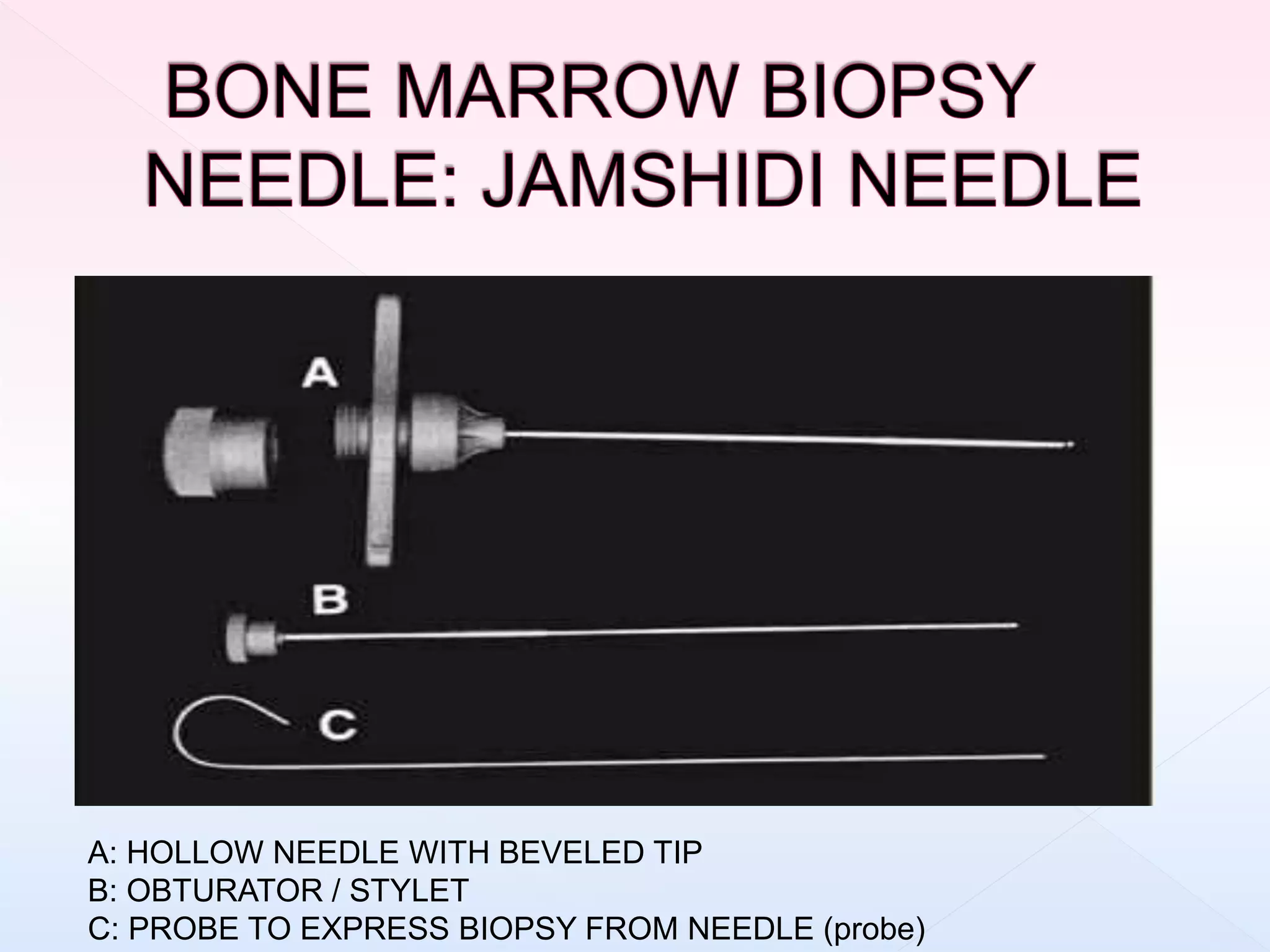 A: HOLLOW NEEDLE WITH BEVELED TIP
B: OBTURATOR / STYLET
C: PROBE TO EXPRESS BIOPSY FROM NEEDLE (probe)
 