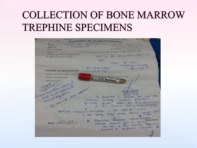 processing-of-bone-marrow-trephine-biopsy-ppt