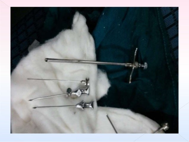 processing-of-bone-marrow-trephine-biopsy