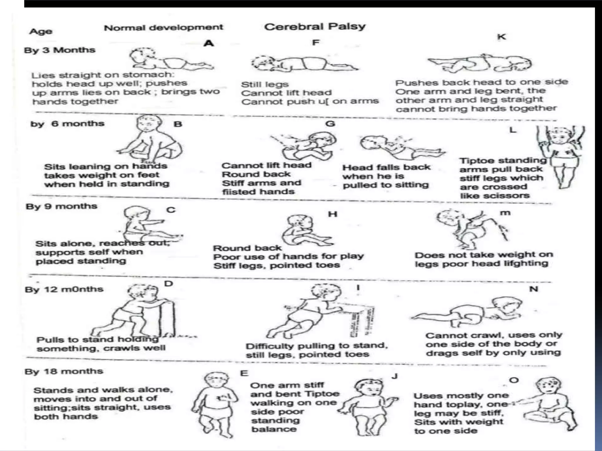 Handling of children with cerebral palsy PPT-vinay (1) (1).pdf