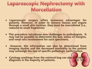 Handling of kidney specimen | PPTX
