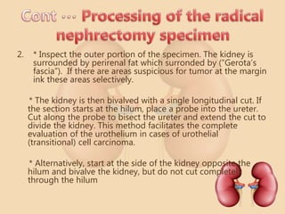 Handling of kidney specimen | PPT