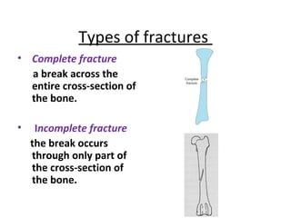Complete Break Management/Transportation of Trauma Victims | PPT