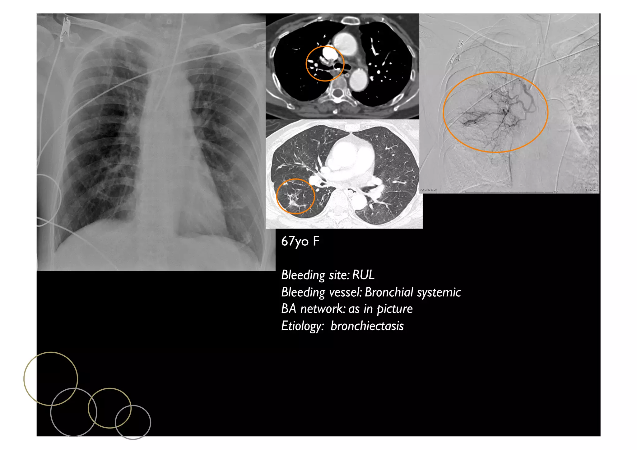 Emergency CT: Updates | PDF