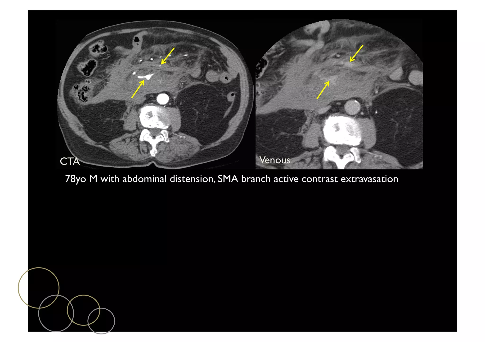 Emergency CT: Updates | PDF