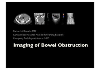 Imaging of Bowel Obstruction	

Rathachai Kaewlai, MD	

Ramathibodi Hospital, Mahidol University, Bangkok	

Emergency Radiology Minicourse 2015 	

 