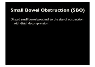 Small Bowel Obstruction (SBO)	

Dilated small bowel proximal to the site of obstruction
with distal decompression	

 