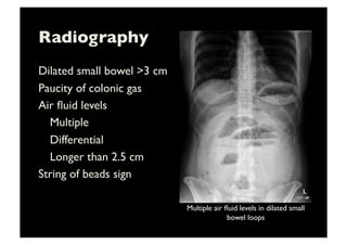 Radiography	

Dilated small bowel 3 cm	

Paucity of colonic gas	

Air ﬂuid levels	

	

Multiple	

	

Differential	

	

Longer than 2.5 cm	

String of beads sign	

Multiple air ﬂuid levels in dilated small
bowel loops	

 