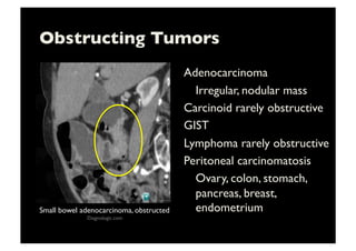Obstructing Tumors	

Adenocarcinoma	

	

Irregular, nodular mass	

Carcinoid rarely obstructive	

GIST	

Lymphoma rarely obstructive	

Peritoneal carcinomatosis	

	

Ovary, colon, stomach,
pancreas, breast,
endometrium	

Small bowel adenocarcinoma, obstructed	

Diagnologic.com	

 